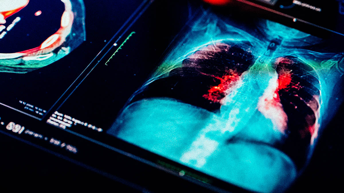 Präzisionsmedizin der Zukunft