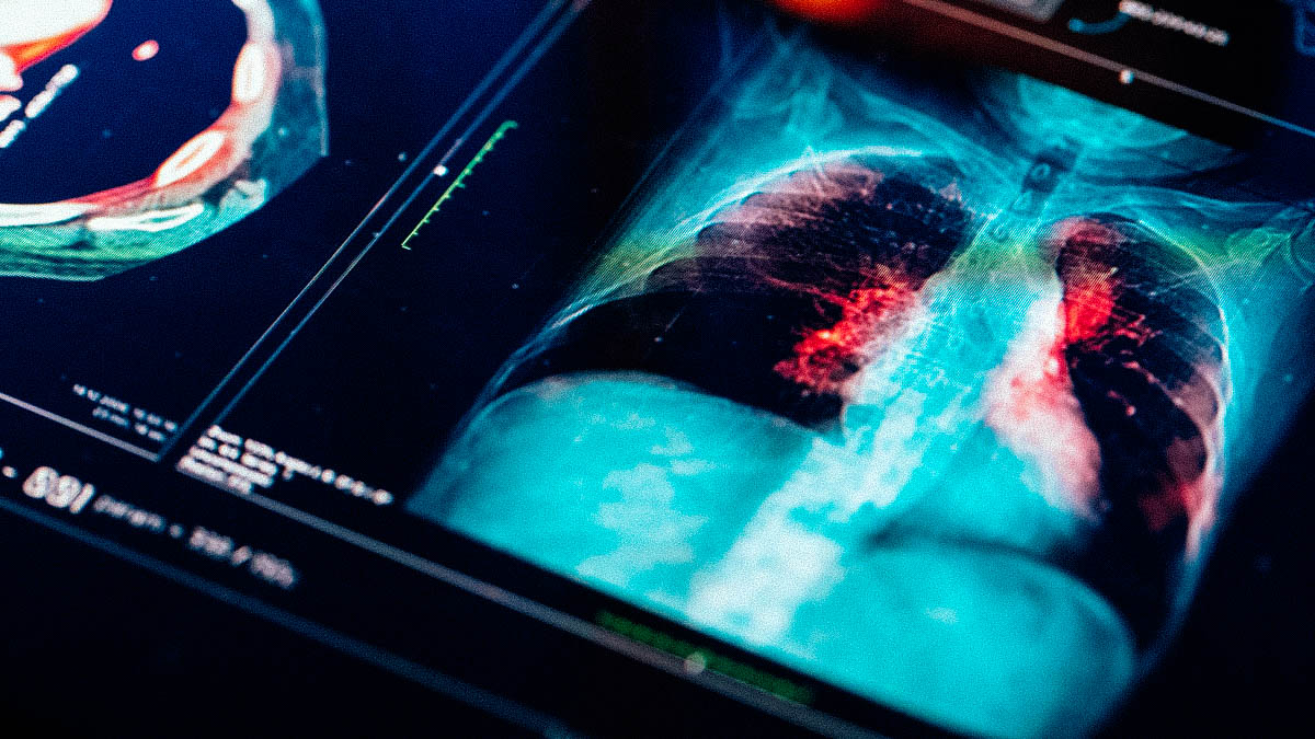 Precision medicine of the future